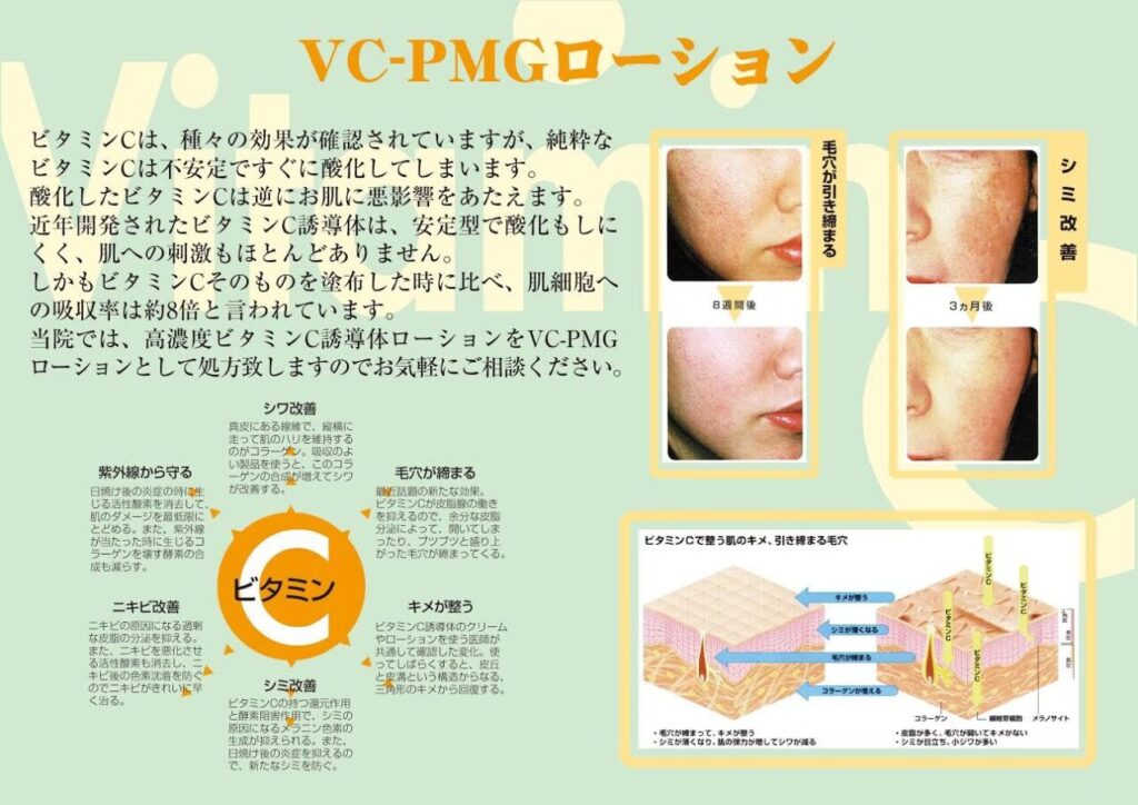 VC-PMGローション